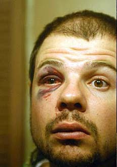 Prosjekt101 blåttøye