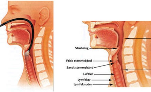 Illustrasjon stemmebånd